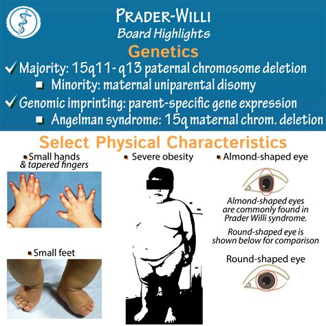 twilly prada|prader willi syndrome.